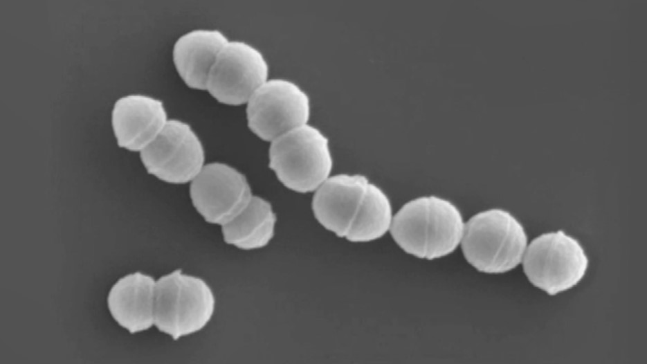 “人食いバクテリア”感染　福岡県内で新たに２人確認　今年計２８人に　去年上回るペース